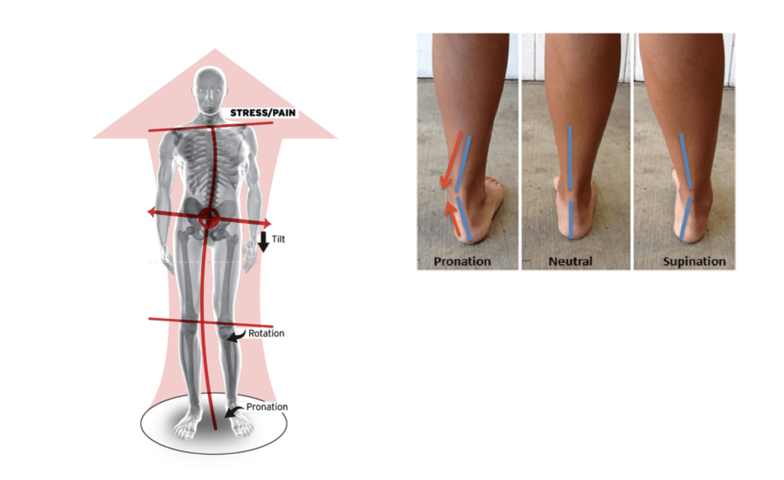 shin pain running